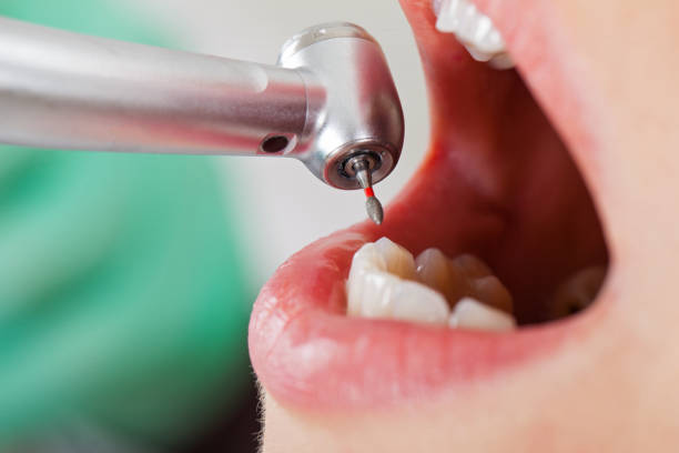 Best Emergency Treatment for Oral Infections in Sea Ranch, CA